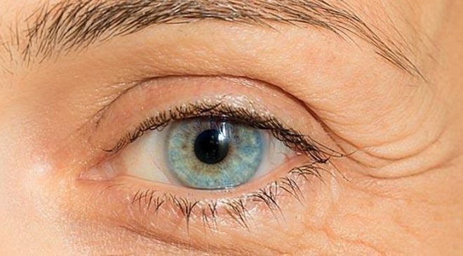Οφθαλμίατρος: Τα σημάδια που δείχνουν πως πρέπει να τον επισκεφτείς