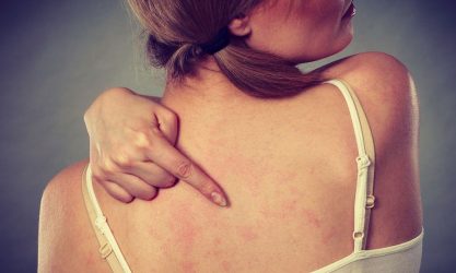 Δωρεάν εξετάσεις για τη κνίδωση στο νοσοκομείο «Παπαγεωργίου»
