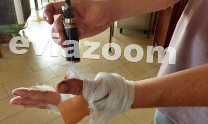 Σοκαριστική στιγμή – Εξερράγη ηλεκτρονικό τσιγάρο στα χέρια του (ΒΙΝΤΕΟ)