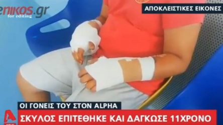 Σκύλος επιτέθηκε και τραυμάτισε σοβαρά 11χρονο (ΒΙΝΤΕΟ)