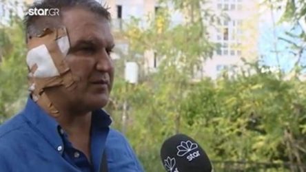 “Δεν πέτυχε η συγκόλληση του αυτιού” – Τι αποκαλύπτει ο παραγωγός-θύμα επίθεσης