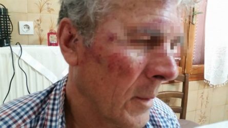 Σάμος: Τούρκοι ξυλοκόπησαν 73χρονο που άκουγε εκκλησιαστική μουσική!