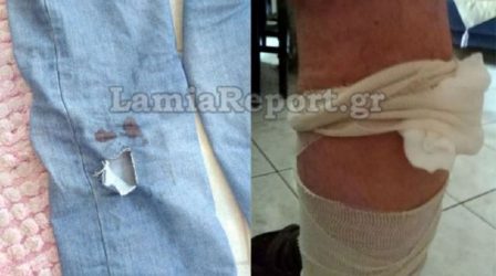 Λαμία: Αγέλη αδέσποτων σκύλων επιτέθηκε σε άνδρα