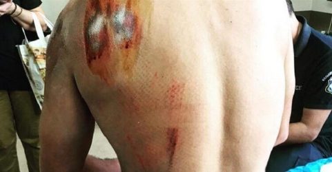 Σκύλος τραυμάτισε σοβαρά ποδηλάτη (Σκληρές εικόνες)