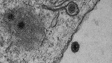 Ένας νέος περίεργος ιός φέρνει βάσανα στους επιστήμονες