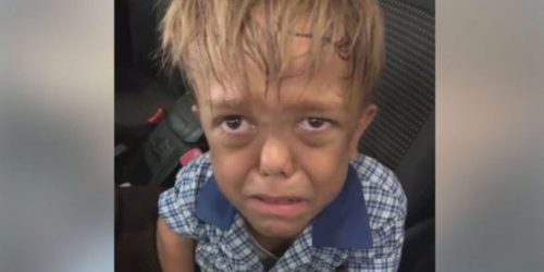 Τεράστιο κύμα συμπαράστασης για τον 9χρονο με νανισμό