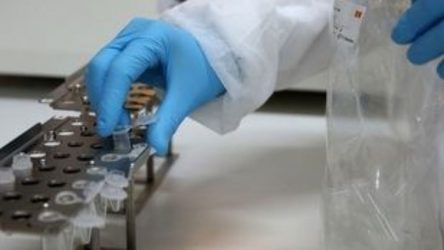 Γαλλία: Κυκλοφόρησε τεστ που διακρίνει τη γρίπη από τον κορονοϊό