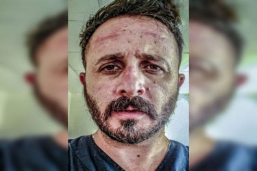 Συγκλονιστική περιγραφή εργαζόμενου του ΠΑΓΝΗ: « Την μάσκα που εσύ αρνείσαι να φορέσεις, εμείς παρακαλάμε να έχουμε»