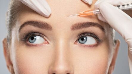 Botox: Τι συμβουλεύει δερματολόγος για καλύτερα αποτελέσματα