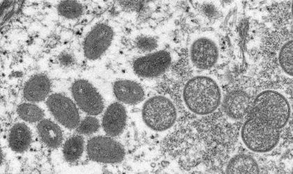 Ηλίας Μόσιαλος για ευλογιά των πιθήκων: Τι γνωρίζουμε μέχρι τώρα για τον ιό