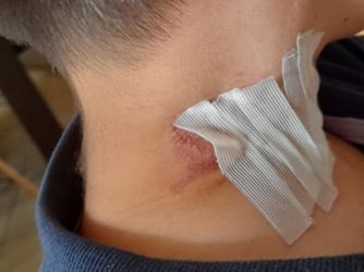 Κρήτη: 7χρονος σχεδόν πνίγηκε από λουρί σκύλου (ΦΩΤΟ)