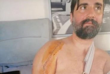 Περιγράφει το ξυλοδαρμό του ο διασώστης από τη Σαλαμίνα: “Με έπιασε, με χτύπησε στον τοίχο” (ΒΙΝΤΕΟ)