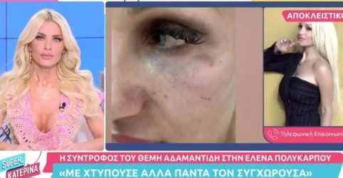 Η Βαρβάρα Κίρκη δακρύζει για το Θέμη Αδαμαντίδη: “Δεν έφυγα νωρίτερα γιατί τον αγάπησα και τον αγαπάω”