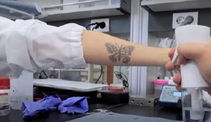 Νότια Κορέα: Επιστήμονες αναπτύσσουν «τατουάζ» νανοτεχνολογίας (ΒΙΝΤΕΟ)