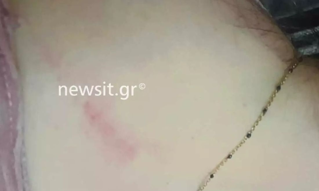 κακοποίηση Θεσσαλονίκη 