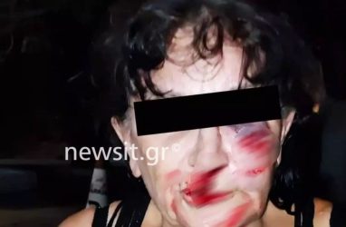 Αίγινα: Προφυλακιστέα τρία άτομα για τον ξυλοδαρμό του ξενοδόχου και της μητέρας του (ΒΙΝΤΕΟ)