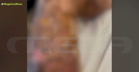 Ατύχημα για 35χρονη: Αποφρακτικό εξερράγη στο σώμα της – “Θυμήθηκα την Παλιοσπύρου” (ΒΙΝΤΕΟ)