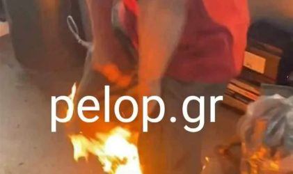 Πάτρα: «Αλλιώς μας τα είπε εμάς» λένε οι Ρομά για τον 35χρονο που είπε τα κάλαντα και τον πυρπόλησαν (ΒΙΝΤΕΟ)