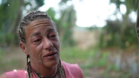 Survivor All Star: Στο νοσοκομείο η Αφροδίτη Σκαφίδα – Πρήστηκε όλο της το πρόσωπο (ΒΙΝΤΕΟ)