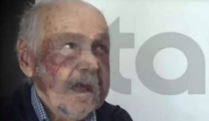 Σοκ: Ληστές έστειλαν στο νοσοκομείο ηλικιωμένο – Του έβγαλαν ακόμη και τα δόντια