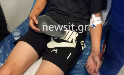 Αγριος ξυλοδαρμός 16χρονου από ανηλίκους 