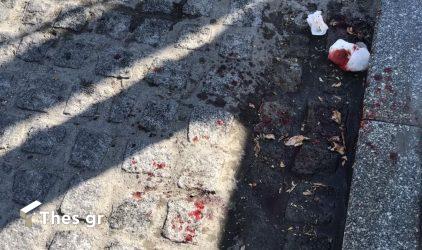 Θεσσαλονίκη: Αυτοκίνητο παρέσυρε και χτύπησε μικρό παιδί στην Ανω Πόλη (ΦΩΤΟ)