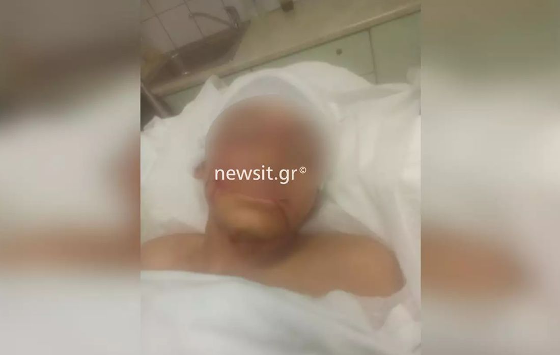 Λούτσα επίθεση πιτ μπουλ 11χρονος