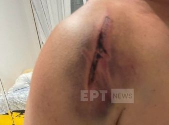 Θεσσαλονίκη: «Με χτυπούσαν όπου έβρισκαν με τα χέρια και με καουτσούκ», αποκαλύπτει ο οδηγός του ΟΑΣΘ
