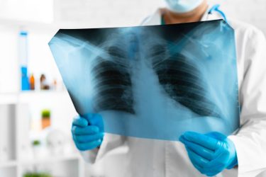 Αύξηση στα κρούσματα πνευμονίας από μυκόπλασμα στην Ευρώπη – Ποιες ηλικίες αφορά