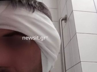 Συγκλονίζει ο διανομέας από την Πέλλα – «Μου έκοψε κομμάτι από το αυτί, το είδα στο στόμα του»