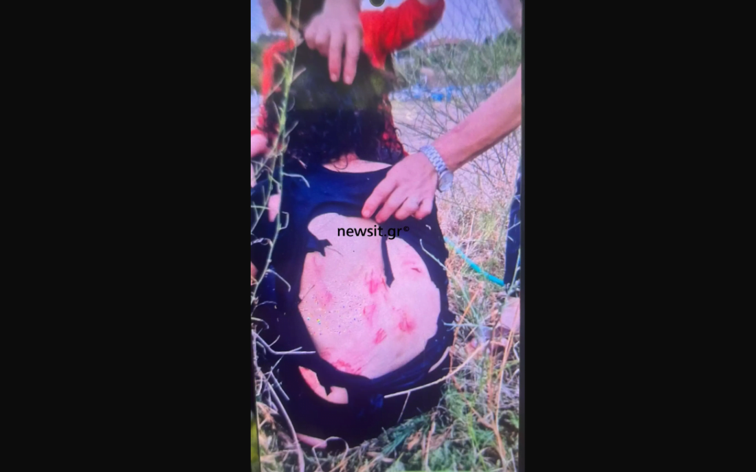 γυναίκα επίθεση από σκύλους Φίλυρο