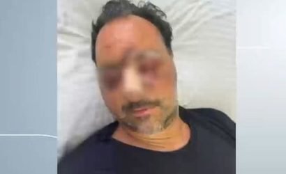 Παραδόθηκαν δύο άνδρες για τον άγριο ξυλοδαρμό του Ελληνοκαναδού