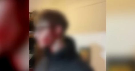 Θεσσαλονίκη: «Ο 16χρονος ήταν μέσα στα αίματα, η 14χρονη φώναζε βοήθεια», αποκαλύπτει αυτόπτης μάρτυρας της επίθεσης