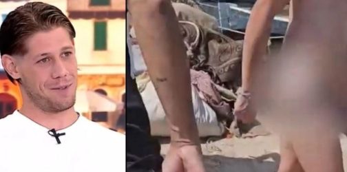 Ο πορνοστάρ που τον δάγκωσε χελώνα έδειξε την πληγή στα... οπίσθια