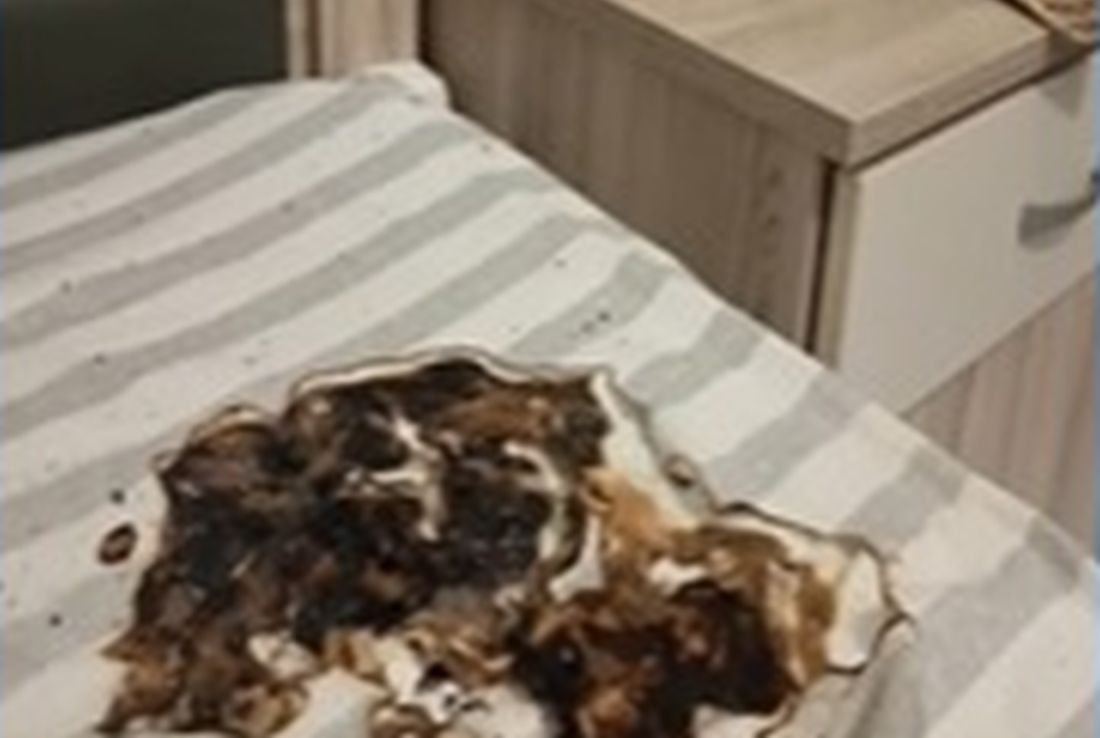 "Εσκασε" κινητό κατά τη διάρκεια της φόρτισης